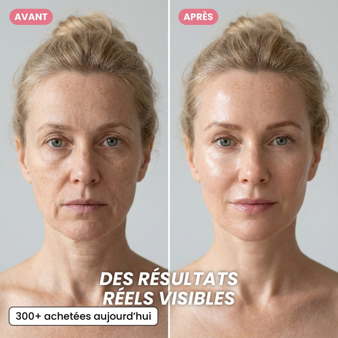 Crème en Capsules au Collagène Rose PDRN