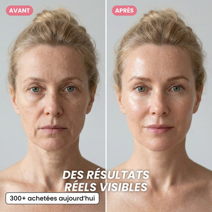 Crème en Capsules au Collagène Rose PDRN