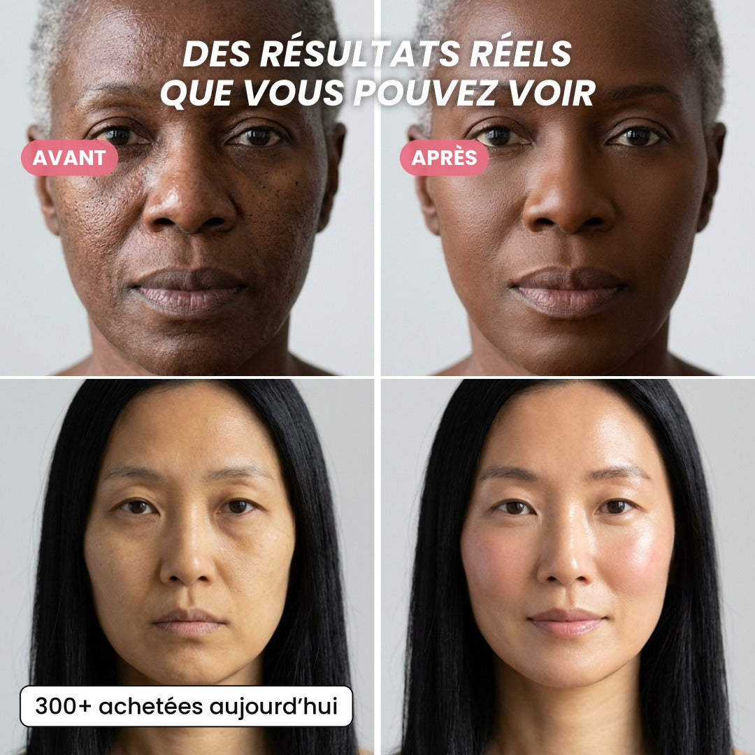 Crème en Capsules au Collagène Rose PDRN