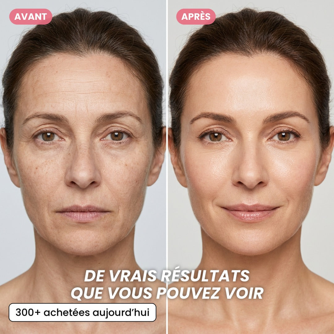 Crème en Capsules au Collagène Rose PDRN