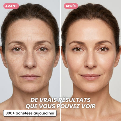Crème en Capsules au Collagène Rose PDRN